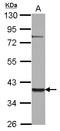 Zinc Finger Protein 302 antibody, LS-C155674, Lifespan Biosciences, Western Blot image 