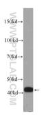 Interleukin 36 Receptor Antagonist antibody, 60298-1-Ig, Proteintech Group, Western Blot image 