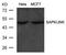 Mitogen-Activated Protein Kinase 9 antibody, 79-380, ProSci, Western Blot image 