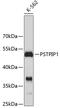 Proline-Serine-Threonine Phosphatase Interacting Protein 1 antibody, 19-323, ProSci, Western Blot image 