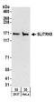 SLIT And NTRK Like Family Member 5 antibody, A304-143A, Bethyl Labs, Western Blot image 