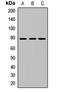 NFKB Inhibitor Zeta antibody, LS-C668529, Lifespan Biosciences, Western Blot image 