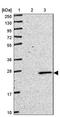 Variable Charge X-Linked antibody, NBP2-46770, Novus Biologicals, Western Blot image 