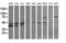 Mitogen-Activated Protein Kinase Kinase 3 antibody, LS-C174434, Lifespan Biosciences, Western Blot image 