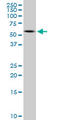 Peripherin antibody, LS-B6138, Lifespan Biosciences, Western Blot image 