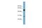 Src-like-adapter antibody, PA5-42141, Invitrogen Antibodies, Western Blot image 