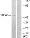 STEAP3 Metalloreductase antibody, GTX87995, GeneTex, Western Blot image 