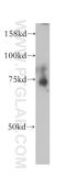 Heat Shock Protein Family A (Hsp70) Member 6 antibody, 13616-1-AP, Proteintech Group, Western Blot image 