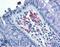 CD209 Molecule antibody, LS-B3782, Lifespan Biosciences, Immunohistochemistry frozen image 