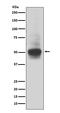RUNX Family Transcription Factor 1 antibody, M00086, Boster Biological Technology, Western Blot image 