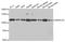 SWI/SNF-related matrix-associated actin-dependent regulator of chromatin subfamily A member 5 antibody, A02687, Boster Biological Technology, Western Blot image 