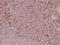 Serpin Family F Member 1 antibody, A02034T307, Boster Biological Technology, Immunohistochemistry frozen image 