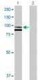 SPG7 Matrix AAA Peptidase Subunit, Paraplegin antibody, H00006687-D01P, Novus Biologicals, Western Blot image 