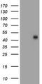 Carboxypeptidase O antibody, TA504707, Origene, Western Blot image 