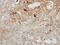 G Protein-Coupled Receptor Kinase 2 antibody, PA5-27480, Invitrogen Antibodies, Immunohistochemistry frozen image 