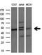 Phosphatidylinositol-5-Phosphate 4-Kinase Type 2 Alpha antibody, M04244, Boster Biological Technology, Western Blot image 