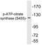 ATP Citrate Lyase antibody, LS-C291482, Lifespan Biosciences, Western Blot image 