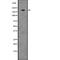 SWI/SNF Related, Matrix Associated, Actin Dependent Regulator Of Chromatin, Subfamily A, Member 4 antibody, abx148694, Abbexa, Western Blot image 
