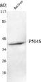 Alpha-Methylacyl-CoA Racemase antibody, STJ98524, St John