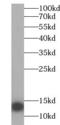 Serum Amyloid A2 antibody, FNab07573, FineTest, Western Blot image 
