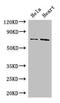 Phosphoenolpyruvate Carboxykinase 2, Mitochondrial antibody, LS-C395152, Lifespan Biosciences, Western Blot image 