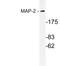 MAP2 antibody, LS-C177550, Lifespan Biosciences, Western Blot image 