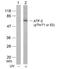 Activating Transcription Factor 2 antibody, 79-114, ProSci, Western Blot image 