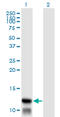 Translocase Of Inner Mitochondrial Membrane 8A antibody, LS-C133151, Lifespan Biosciences, Western Blot image 