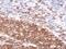 CD20 antibody, GTX21310, GeneTex, Immunohistochemistry paraffin image 