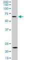 Zinc Finger With KRAB And SCAN Domains 3 antibody, H00080317-M16, Novus Biologicals, Western Blot image 