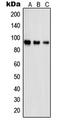 Proteasome 26S Subunit, Non-ATPase 2 antibody, LS-C352734, Lifespan Biosciences, Western Blot image 