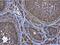 Autophagy Related 4D Cysteine Peptidase antibody, NBP1-33488, Novus Biologicals, Immunohistochemistry paraffin image 