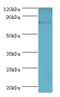 G Protein-Coupled Receptor Kinase 2 antibody, LS-C375163, Lifespan Biosciences, Western Blot image 