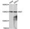 Ret Proto-Oncogene antibody, A11802, ABclonal Technology, Western Blot image 