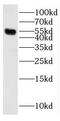 ETS Transcription Factor ERG antibody, FNab02838, FineTest, Western Blot image 