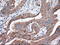 Tetratricopeptide Repeat Domain 32 antibody, GTX83482, GeneTex, Immunohistochemistry paraffin image 