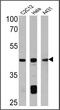 Actin Alpha 2, Smooth Muscle antibody, MA5-11547, Invitrogen Antibodies, Western Blot image 