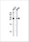 Estradiol 17-beta-dehydrogenase 12 antibody, A07397-1, Boster Biological Technology, Western Blot image 
