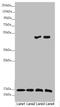 NADH:Ubiquinone Oxidoreductase Subunit S6 antibody, LS-C676139, Lifespan Biosciences, Western Blot image 