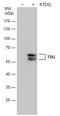 Thymine DNA Glycosylase antibody, GTX631934, GeneTex, Western Blot image 