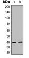 Insulin gene enhancer protein ISL-2 antibody, LS-C358782, Lifespan Biosciences, Western Blot image 