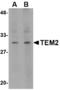 RASD Family Member 2 antibody, LS-C53214, Lifespan Biosciences, Western Blot image 