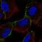 Hyaluronan Synthase 1 antibody, PA5-64330, Invitrogen Antibodies, Immunofluorescence image 