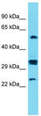 Cancer/Testis Antigen Family 47 Member A9 antibody, TA335926, Origene, Western Blot image 