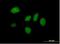 Death Inducer-Obliterator 1 antibody, H00011083-B01P, Novus Biologicals, Immunocytochemistry image 