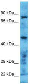 Transmembrane Serine Protease 11B antibody, TA330793, Origene, Western Blot image 