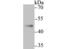 Nuclear Receptor Subfamily 0 Group B Member 1 antibody, A01521-1, Boster Biological Technology, Western Blot image 