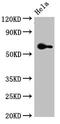 Frizzled-4 antibody, CSB-PA890755LA01HU, Cusabio, Western Blot image 