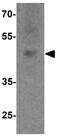 SRY-Box 18 antibody, GTX31587, GeneTex, Western Blot image 