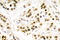 Checkpoint Kinase 2 antibody, LS-C177890, Lifespan Biosciences, Immunohistochemistry frozen image 